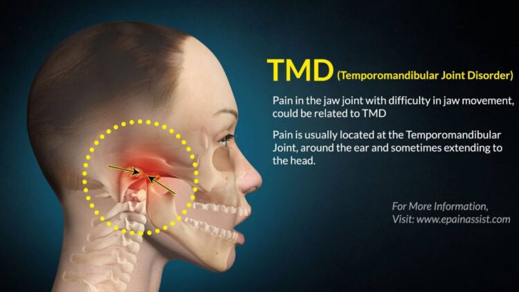 TMD and Acupuncture - Ponsonby Wellness