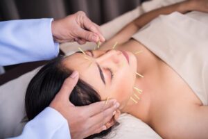medical beauty acupuncture