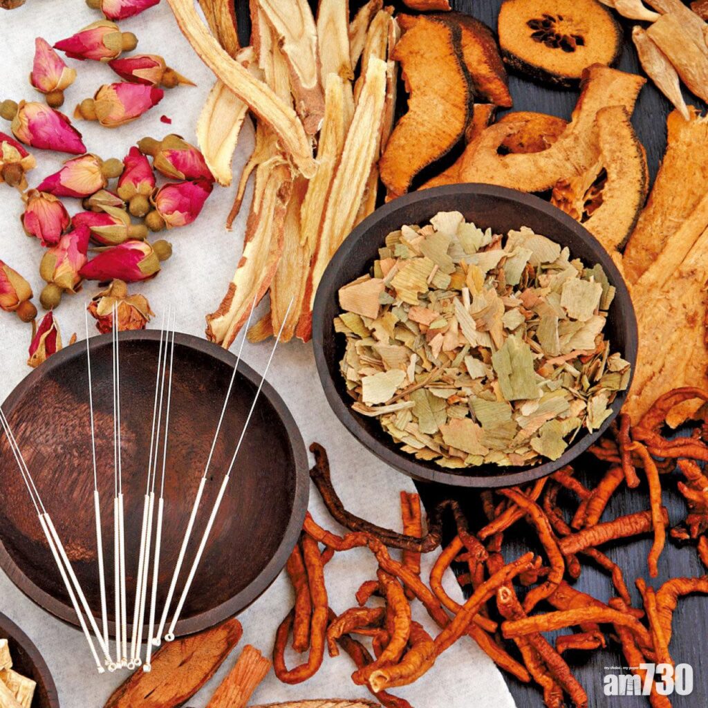 acupuncture for PCOS