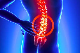 intervertebral disk herniation