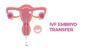 embryo transfer